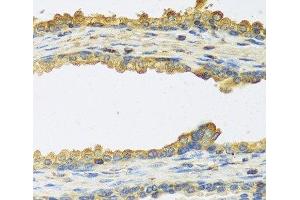 Immunohistochemistry of paraffin-embedded Human prostate using TSHB Polyclonal Antibody at dilution of 1:100 (40x lens). (TSHB antibody)