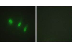 Peptide - +Western blot analysis of extracts from K562 cells, using FOXO4 (Ab-451) antibody. (FOXO4 antibody)