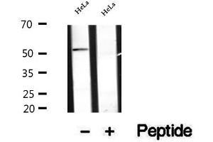 Western blot analysis of extracts of HeLa cells, using Secretogranin III antibody. (SCG3 antibody  (Internal Region))