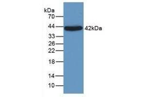Detection of a1AGP in Rat Liver Tissue using Monoclonal Antibody to Alpha-1-Acid Glycoprotein (a1AGP) (ORM1 antibody  (AA 19-201))