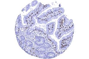Duodenum mucosa Duodenal mucosa containing numerous intraepithelial CD8 positive lymphocytes (Recombinant CD8 antibody  (AA 135-235))