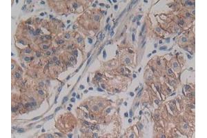 DAB staining on IHC-P; Samples: Human Stomach Tissue (ABCC4 antibody  (AA 1041-1274))
