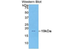 Detection of Recombinant SI, Human using Polyclonal Antibody to Sucrase Isomaltase (SI)