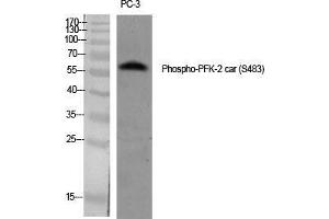 Western Blot (WB) analysis of specific cells using Phospho-PFK-2 car (S483) Polyclonal Antibody. (PFKFB2 antibody  (pSer483))