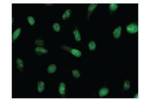 Immunostaining analysis in HeLa cells. (CRNKL1 antibody)