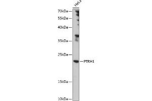 Western blot analysis of extracts of HeLa cells, using PTRH1 antibody (ABIN7269210) at 1:1000 dilution. (PTRH1 antibody  (AA 1-214))