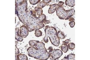 Immunohistochemical staining of human placenta with ZNF320 polyclonal antibody  shows moderate cytoplasmic positivity in trophoblastic cells. (ZNF320 antibody)