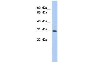 WB Suggested Anti-ZNF771 Antibody Titration:  0.