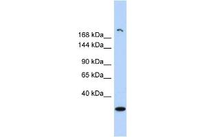 WB Suggested Anti-UTY Antibody Titration: 0. (UTY antibody  (Middle Region))