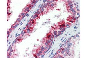 Anti-BCL11A antibody IHC of human prostate. (BCL11A antibody  (N-Term))