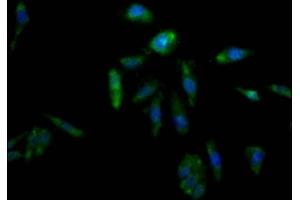 Immunofluorescence staining of Hela Cells with ABIN7127330 at 1:50, counter-stained with DAPI. (Recombinant AKR1C3 antibody)