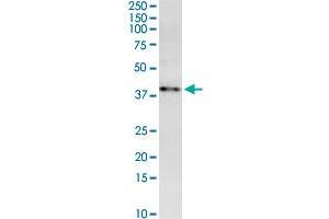 MARCH9 monoclonal antibody (M01), clone 2B5. (MARCH9 antibody  (AA 240-345))