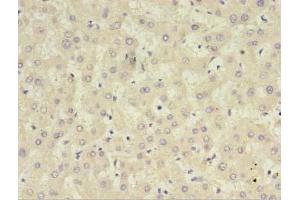 Immunohistochemistry of paraffin-embedded human liver tissue using ABIN7148394 at dilution of 1:100 (CFHR2 antibody  (AA 20-269))