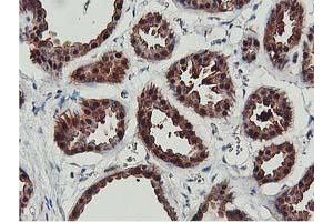 Image no. 9 for anti-CoA Synthase (COASY) antibody (ABIN1497556) (COASY antibody)