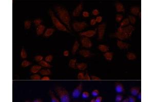 Immunofluorescence analysis of 293T cells using NAT2 Polyclonal Antibody at dilution of 1:100 (40x lens). (NAT2 antibody)