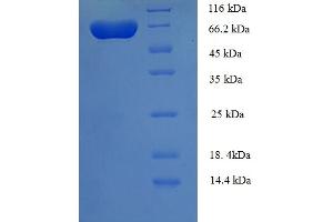 SDS-PAGE (SDS) image for UDP-Glucose Pyrophosphorylase 2 (UGP2) (AA 1-497), (Isoform 2) protein (His-SUMO Tag) (ABIN5711297)
