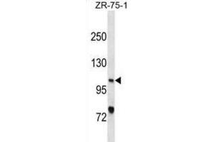 Western Blotting (WB) image for anti-Xeroderma Pigmentosum, Complementation Group C (XPC) antibody (ABIN3001097)