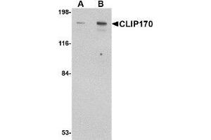 Western blot analysis of CLIP170 in rat brain tissue lysate with AP30237PU-N CLIP170 antibody at (A) 0.