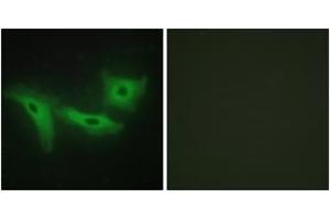 Immunofluorescence analysis of HeLa cells, using LRRK1 Antibody. (LRRK1 antibody  (AA 361-410))