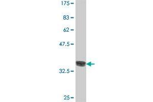 Western Blot detection against Immunogen (36. (MARCH6 antibody  (AA 2-91))