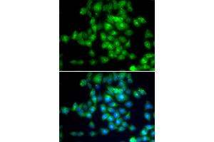 Immunofluorescence analysis of MCF7 cell using SIRT3 antibody. (SIRT3 antibody)