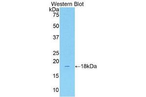 Western Blotting (WB) image for anti-Solute Carrier Family 12 (Sodium/Chloride Transporters), Member 3 (SLC12A3) (AA 3-146) antibody (ABIN1176282) (SLC12A3 antibody  (AA 3-146))