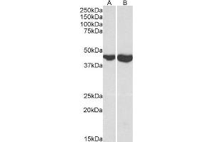 Western Blotting (WB) image for Glutamic-Oxaloacetic Transaminase 2, Mitochondrial (Aspartate Aminotransferase 2) (GOT2) (AA 295-306) peptide (ABIN369242) (Glutamic-Oxaloacetic Transaminase 2, Mitochondrial (Aspartate Aminotransferase 2) (GOT2) (AA 295-306) Peptide)
