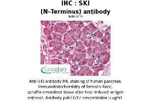 Image no. 1 for anti-SKI Proto-Oncogene (SKI) antibody (ABIN1739312)