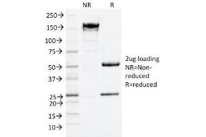 SDS-PAGE Analysis Purified NGFR Mouse Monoclonal Antibody (NGFR/1964). (NGFR antibody  (AA 281-421))
