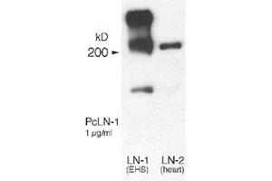 Western blot analysis of Lama1 using Lama1 polyclonal antibody .