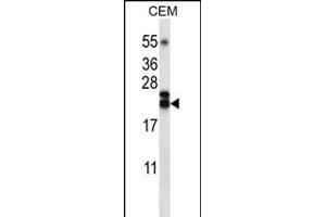 TNFSF4 Antibody (Center) (ABIN656220 and ABIN2845537) western blot analysis in CEM cell line lysates (35 μg/lane). (TNFSF4 antibody  (AA 102-131))