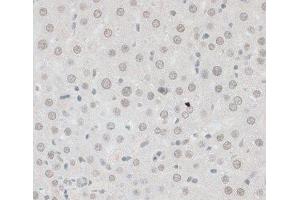 Immunohistochemistry of paraffin-embedded Rat liver using ZNF148 Polyclonal Antibody at dilution of 1:100 (40x lens). (ZNF148 antibody)