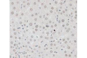 ZNF148 antibody