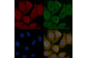 IGBP1 Mouse Monoclonal Antibody staining Hela cells by IF/ICC.