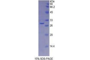 SDS-PAGE analysis of Mouse Galactosidase beta Protein. (GLB1 Protein)