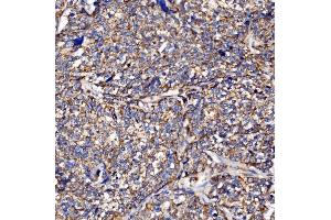 IHC analysis of PMPCA/INPP5 using anti-PMPCA/INPP5 antibody (ABIN7602722). (PMPCA antibody  (AA 99-525))