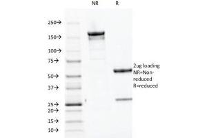 SDS-PAGE Analysis of Purified, BSA-Free Parathyroid Hormone Antibody (clone PTH/1174). (PTH antibody  (AA 32-115))