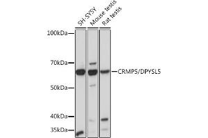 Western blot analysis of extracts of various cell lines, using CRMP5/DPYSL5 Rabbit mAb (ABIN7266774) at 1:1000 dilution. (DPYSL5 antibody)