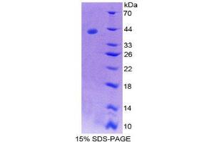 SDS-PAGE (SDS) image for Tachykinin 3 (TAC3) (AA 29-102) protein (His tag,GST tag) (ABIN2123375)