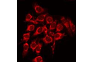 ABIN6268750 staining 293 by IF/ICC. (Patched 1 antibody)