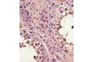 (ABIN6243665 and ABIN6578886) staining FA in human testis tissue sections by Immunohistochemistry (IHC-P - paraformaldehyde-fixed, paraffin-embedded sections). (FAM3A antibody  (AA 201-230))