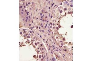 (ABIN6243665 and ABIN6578886) staining FA in human testis tissue sections by Immunohistochemistry (IHC-P - paraformaldehyde-fixed, paraffin-embedded sections).