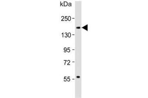 Western blot testing of human spleen lysate with CD11b antibody. (CD11b antibody  (AA 253-282))