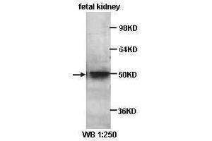 Western Blotting (WB) image for anti-Kruppel-Like Factor 8 (KLF8) antibody (ABIN1856579) (KLF8 antibody)
