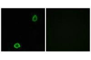 Immunofluorescence analysis of A549 cells, using ABCA13 antibody. (ABCA13 antibody)
