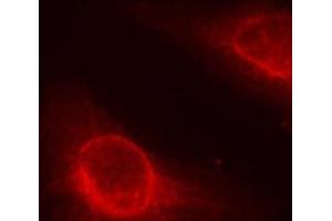 Immunofluorescence analysis of methanol-fixed HeLa cells using Phospho-CFL1(S3) Polyclonal Antibody (Cofilin antibody  (pSer3))