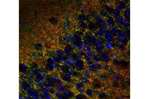 Immunohistochemistry (IHC) image for anti-Tumor Protein P63 Regulated 1-Like (TPRG1L) antibody (ABIN1742502) (TPRG1L antibody)