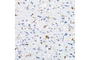 Immunohistochemistry (IHC) image for anti-HLA-DR-gamma (CD74) (AA 73-232) antibody (ABIN6138228)