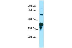 WB Suggested Anti-SPG21 Antibody Titration: 1. (SPG21 antibody  (C-Term))