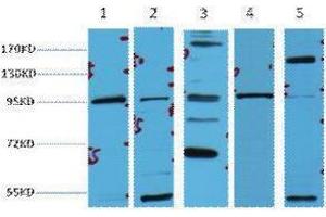 Western Blotting (WB) image for anti-Catenin, beta (CATNB) antibody (ABIN3181135) (beta Catenin antibody)
